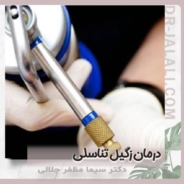 درمان زگیل تناسلی