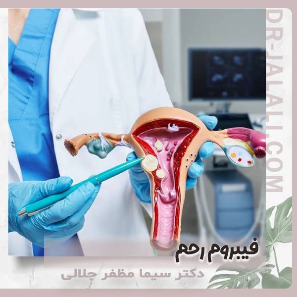 عکس فیبروم رحم