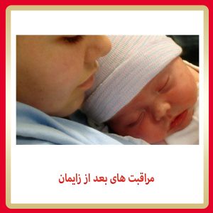 مراقبت های بعد از زایمان