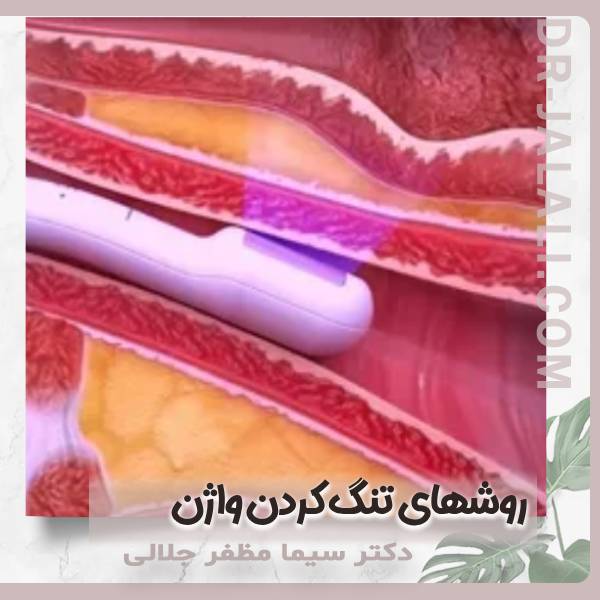 روشهای تنگ کردن واژن