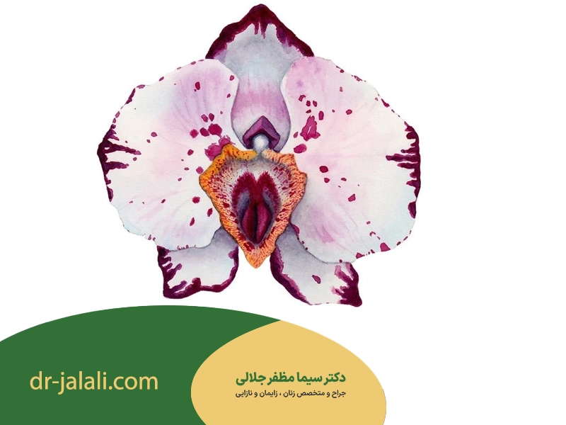 واژینوپلاستی