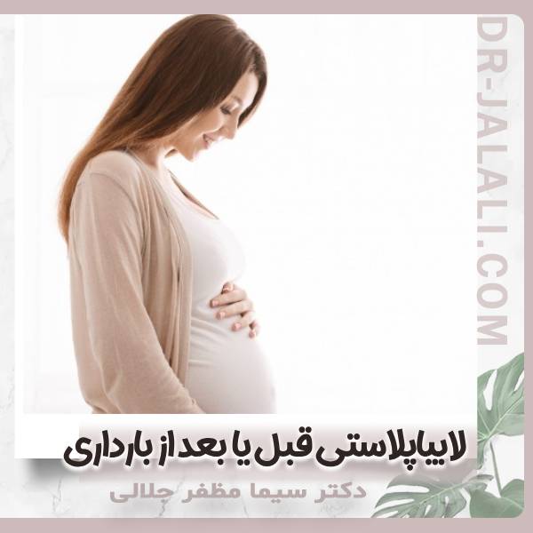 لابیاپلاستی بعد از زایمان