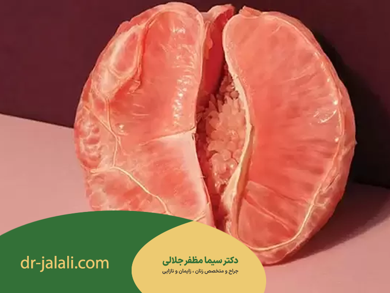 اهمیت خونریزی بعد از لابیاپلاستی