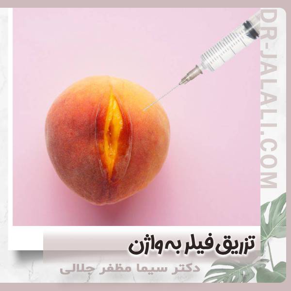 تزریق فیلر به واژن