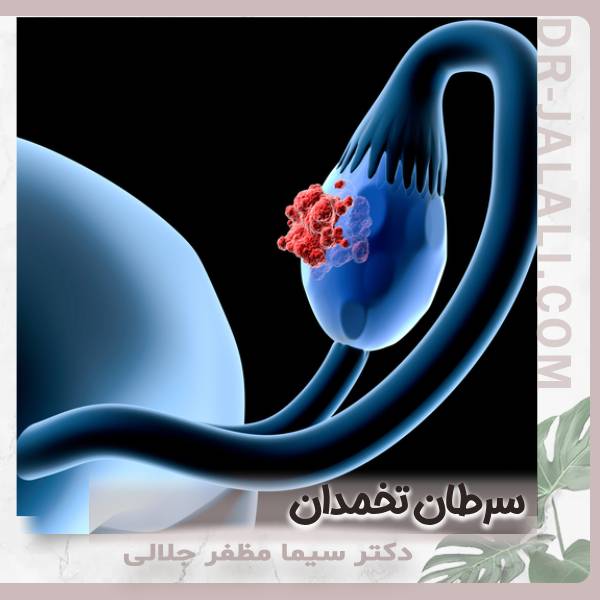 عکس سرطان تخمدان