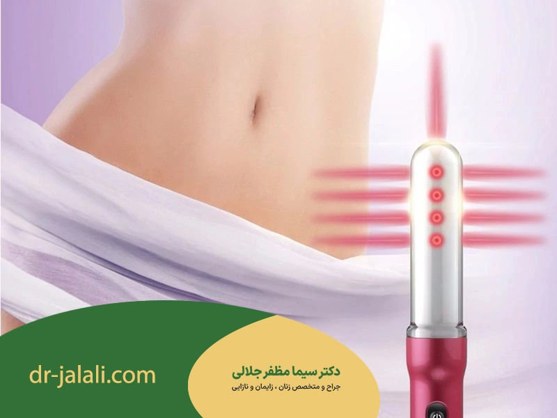 عکس لیزر تنگ کننده واژن