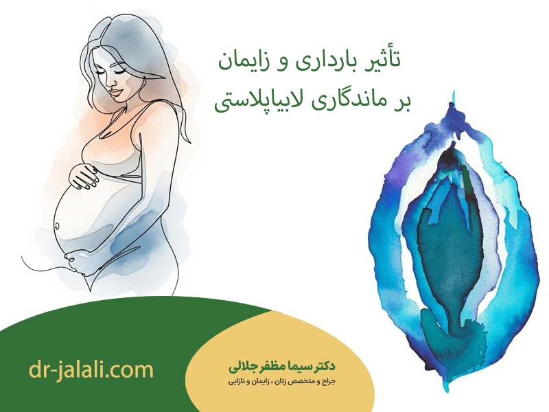 تأثیر بارداری و زایمان بر ماندگاری لابیاپلاستی