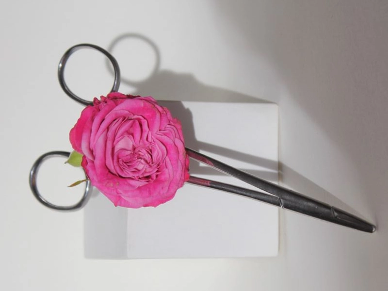 ماندگاری لابیاپلاستی معمولاً چقدر است؟