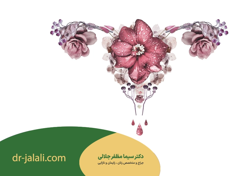 مراقبت‌های بعد از عمل لابیاپلاستی